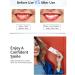 14 Pieces Teeth Whitening Strips - Fast Stain Removal for Bright Smiles | Best Bleaching Stripes for Home Use - Buy Online on GoSupps.com