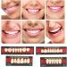 Temporary Tooth Repair Set - Synthetic Resin Filling for Lost Teeth | Dental Care Tools for International Shipping - Buy Online on GoSupps.com