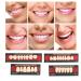 High-Quality Synthetic Resin False Teeth | Dental Prosthesis for Oral Cavity Loss - Buy Online on GoSupps.com