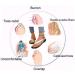 Women's Flat Slide Sandals - Open Toe Bunion Corrector with Adjustable Buckle | Summer Casual Beach Shoes for Big Toe Bone Correction & Arch Support - Size 7 White - Buy Online on GoSupps.com
