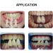 Dental Shade Guide - 16/29 Colors Teeth Bleaching Tool | Teeth Whitening Plate International Shipping - Buy Online on GoSupps.com