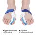 High-Quality Bunion Rails & Hallux Separator for Women | Fotabpyti Bunion Corrector & Health Care Socks - Buy Online on GoSupps.com
