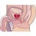 High-Quality Male Testicle Simulator for Testicular Cancer Palpation - Science Lab Training Model | International Shipping - Buy Online on GoSupps.com