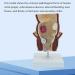 Human Rectal Hemorrhoid Lesions ical Model Colon Anal Sphincter Anorectal Teaching Specimen - Buy Online on GoSupps.com