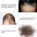Hair Fibers Spray for Men & Women - Thickening Concealer & Applicator Pump - Toppik Hair Building Solution - Buy Online on GoSupps.com