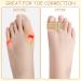 12Pcs Toe Spacers for Women - Bunion Corrector & Toe Straighteners - Gel Toe Spreaders - Toe Protectors & Separators for Bunion Overlapping Hammer Crooked Big Toes (Beige) - Buy Online on GoSupps.com