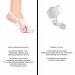 2024 Bunion Corrector & Big Toe Separator | Pain Relief Splint for Football Injury | Day & Night Support - 2PC Orange Large - Buy Online on GoSupps.com