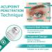 OphthlaMed Vision Enhance Roller - Relieve Eye Strain, Enhance Visual Clarity - 1PCS/8mm (4pcs) - Buy Online on GoSupps.com