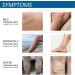 Varicose Veins Cream - Spider Veins Repair & Treatment for Legs | Relief Ointment - Buy Online on GoSupps.com
