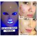 NEWKEY Red Blue Light Therapy LED Face Mask - Acne & Wrinkle Treatment Korea PDT Technology - Buy Online on GoSupps.com