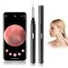 LOOYUAN Ear Wax Removal Endoscope Earwax Remover Tool Wireless Ear Otoscope Ear Camera with 6 LED Lights Ear Scope with Ear Wax Cleaner Tool Visual Ear Endoscope Kit for Kids Adults Android iOS