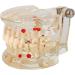 Dental Teeth Model for Parodontopathy Disease Transparent Removable Gingivae Pathology Teeth Model Used in Teaching Explain Studying for Adult - Buy Online on GoSupps.com