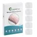 5pcs Suture Free Wound Closure Strips  Zip Stitch Sutures  Butterfly Bandaids  Emergency Wound Closure Device  Laceration Repair Without Stitches  Wound Care for First Aid Kits