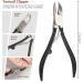 Segbeauty 9PCs Professional Pedicure Knife Set - High Manganese Steel Nail Care Tools for Ingrown Nails & Corn Removal - Buy Online on GoSupps.com