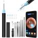Ear Wax Removal Kit Camera 1080P FHD Ear Camera-Upgraded Anti-Fall Off Eartips Ear Cleaner Wireless Ear Wax Remover(3.5mm Ear Endoscope/6 LED Lights)Otoscope for iPhone ipad Android/Adults Kids Pets.