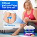 Varicose Veins Cream - Effective Treatment for Legs | Strengthen Capillaries, Improve Circulation | Relief Phlebitis Angiitis Inflammation | 1.7 Fl Oz - Buy Online on GoSupps.com