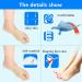 YUYTE Hallux Valgus Corrector - Bunion Orthotics for Women Men - Toe Separator & Alignment Orthopedic Brace [S] - Buy Online on GoSupps.com