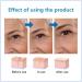 Hyalu B5 Serum Hyaluronic Acid B5 Serum Anti Aging Serum Face Serum Concentrate Hyaluronic Acid Serum for Face - Anti Aging Instant Face Firming & Plumping Face Fade Fine Lines 30ml - Buy Online on GoSupps.com
