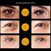 TIREOW Women Snake Venom Eye Cream | Remove Dark Circles & Wrinkles | Anti-Aging Eye Serum | Boosts Hydration & Radiance - Buy Online on GoSupps.com