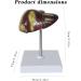 Liver Anatomy Model Human Liver Disease Model Liver Fat/Cirrhosis/Pathological Hepatobiliary Disease Model Medical Education and Training Auxiliary Human Organ Anatomical Model - Buy Online on GoSupps.com
