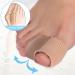 Miskall Toe Sleeves - Toe Straightener & Protector with Gel Spacers - Buy Online on GoSupps.com