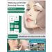 WHITENING and Freckle-Removing Facial Cleanser Refreshing Oil Control Freckle Removal and Nicotinamide Brightening Skin Tone (Color : 1PCS) - Buy Online on GoSupps.com