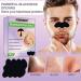 Blackhead Nose Strips Nose Strips Anti Nose Stripes Blackheads 18 Pieces Pore Strips Pore Cleaning with Activated Carbon Remove Blackheads and Impurities with Blackhead Remover Comedone - Buy Online on GoSupps.com