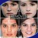 Removal Mark Pimple Pro Blemish Scar Spots Ointment for Glass Skin - White One Size - Buy Online on GoSupps.com