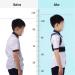 Adjustable Posture Corrector Back Support Belt Orthopedic Corset Spine Back Lumbar Shoulder Braces Tools - Buy Online on GoSupps.com