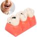 Verdant Touch Simulation Teeth Caries Model - Removable Tooth Caries Demonstration for Dental Education | International Shipping - Buy Online on GoSupps.com