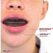 Safejawz Orthodontic Sports Mouthguard Bundle with Cleaner Spray (Black) - Buy Online on GoSupps.com