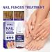 ZERZK 10ml Repair Nail Fungus Treatments Essence Foot Care Nails AntiInfection Toe Fungus Serum Onychomycosis Removal Gel - Buy Online on GoSupps.com