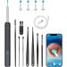 DELR Visual Ear Wax Remover with 1080p Camera & Wi-Fi Complete 8-Part Set with Ear Spoons LED Lights | Compatible with Phone Tablet & PC | Perfect Gift - Buy Online on GoSupps.com