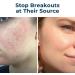 VitaMedica Clear Skin Bundle | Natural Nutraceutical & Probiotic Cleanser & Moisturizer for Breakout-Prone Skin - Shop Internationally - Buy Online on GoSupps.com
