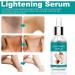 Skin Whitening Serum Skin Lightening Serum For Body Underarms Armpit Knees and Inner Thigh Dark Spot Remover Corrector Cream for Body Hyperpigmentation Treatment 1 - Buy Online on GoSupps.com