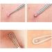 Professional Blackhead and Whitehead Remover Tool | Stainless Steel Pimple Extractor for Blemish and Comedone Removal - Buy Online on GoSupps.com