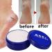 Hand Foot Crack Cream Anti Dry Chapped Cream Dry Skin Heel Chapped Peeling Ointment Hydrating Foot Cream Moisturizes for Healthy Feet Softens Conditions Dry Cracked Feet (33g) - Buy Online on GoSupps.com