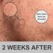 Derma Roller Microneedle Roller For Face Roller for Beard Microneedling Roller | For Women and Men | Micro Needle Roller For Face Scalp Derma Stamp 0.5mm - Buy Online on GoSupps.com
