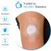 Kuruyo Freestyle Sensor Adhesive Bandage Patches for Libre 2 - Pack of 60 Waterproof Clear Film Patches in Blue - Buy Online on GoSupps.com