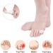 Soft Gel Toe Separator for Bunion Correction - Comfortable SEBS Toe Spacers for Men & Women - Hammer Toe & Big Toe Straightener - High Elasticity White - Buy Online on GoSupps.com