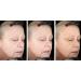 Buy Miracle Wrinkle Filler - 90 Second Results with Hyaluronic Acid for Youthful Skin | Fast International Shipping - Buy Online on GoSupps.com
