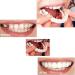 Xindinuo Snap-On Veneer Teeth - 2 Pairs | Instant Dentures for Men & Women for Confident Smile - Buy Online on GoSupps.com