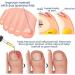 German Toenailcare Paronychia & Bunion Relief Oil for Thick, Discolored Nails - 1Pcs - Buy Online on GoSupps.com