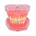 Buy Multifarious Dental Models for Teaching & Studying | Removable Teeth Implant & Orthodontic Demo Models (M7008) - Ideal for Dentists & Students - Buy Online on GoSupps.com