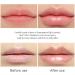 Nnbwlmaee Alicroplct Vitamin E Lip Serum | Natural Lip Plumper & Care | Instant Lip Filler (1PC) - Buy Online on GoSupps.com