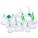 ULTNICE Chinese Medical Body Massage Cupping