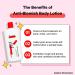 TIAM Anti-Blemish Body Lotion - Body Acne Treatment for Bacne & Scars - 6.76 FL.OZ - Buy Online on GoSupps.com