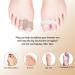 NICENEEDED 8pcs Gel Toe Separators & Bunion Corrector - Comfortable Toe Spacers for Hammer Toe Relief | International Shipping - Buy Online on GoSupps.com