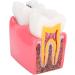 Buy Caries Comparison Study Models | Dental Anatomy Teeth Models for Dentist Education - International Shipping - Buy Online on GoSupps.com