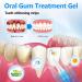 Remove Oral Gum Treatment Gel - Tooth Elevator Essence Pin & Protection - 3 PCs for Gum Residue Stains & Tartar Removal - Buy Online on GoSupps.com